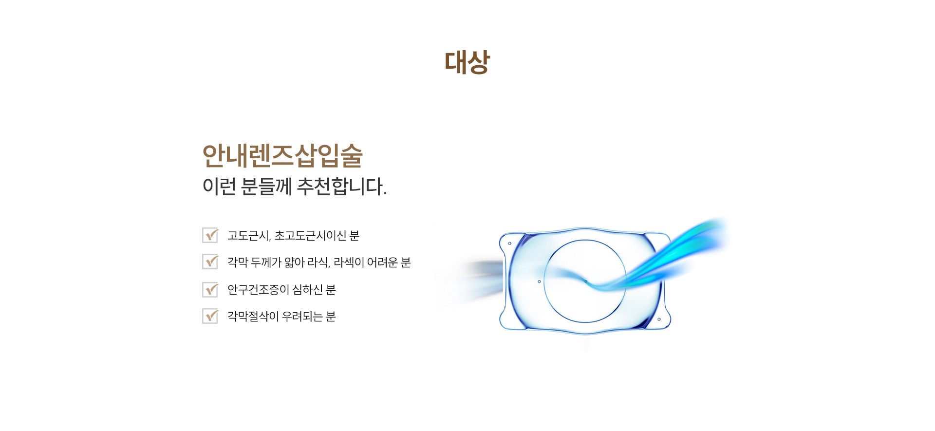 렌즈삽입술
