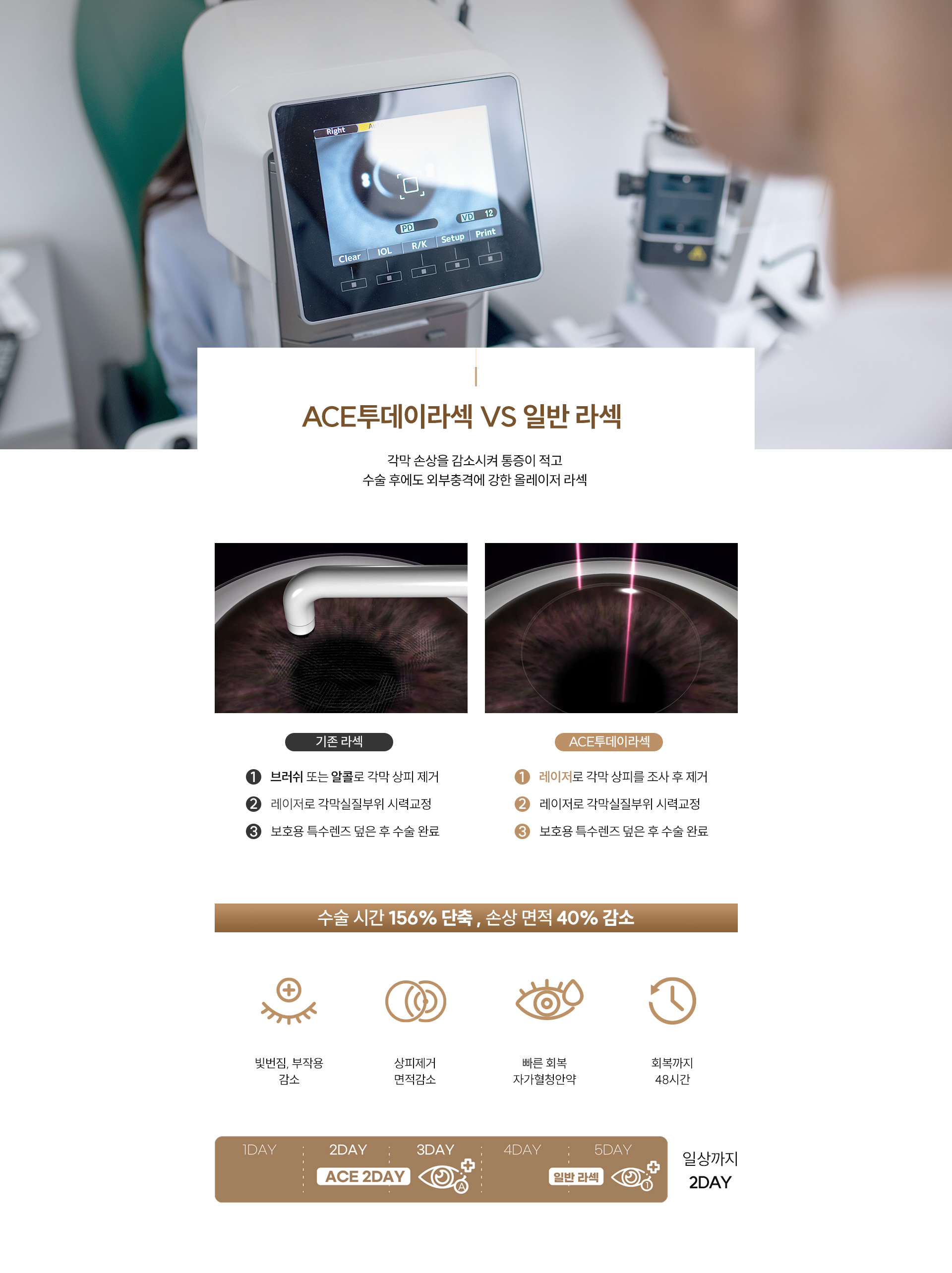 ACE투데이라섹VS일반라섹