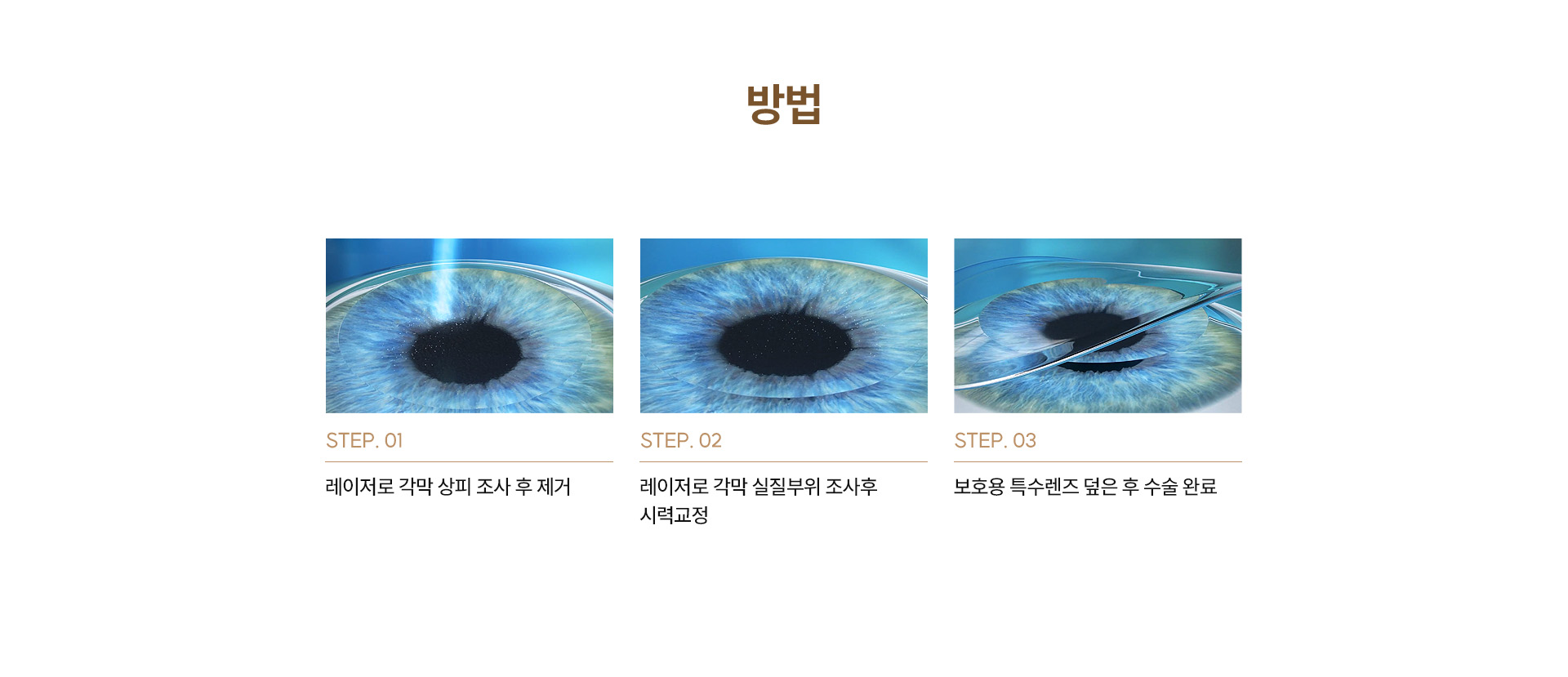 ACE투데이라섹VS일반라섹