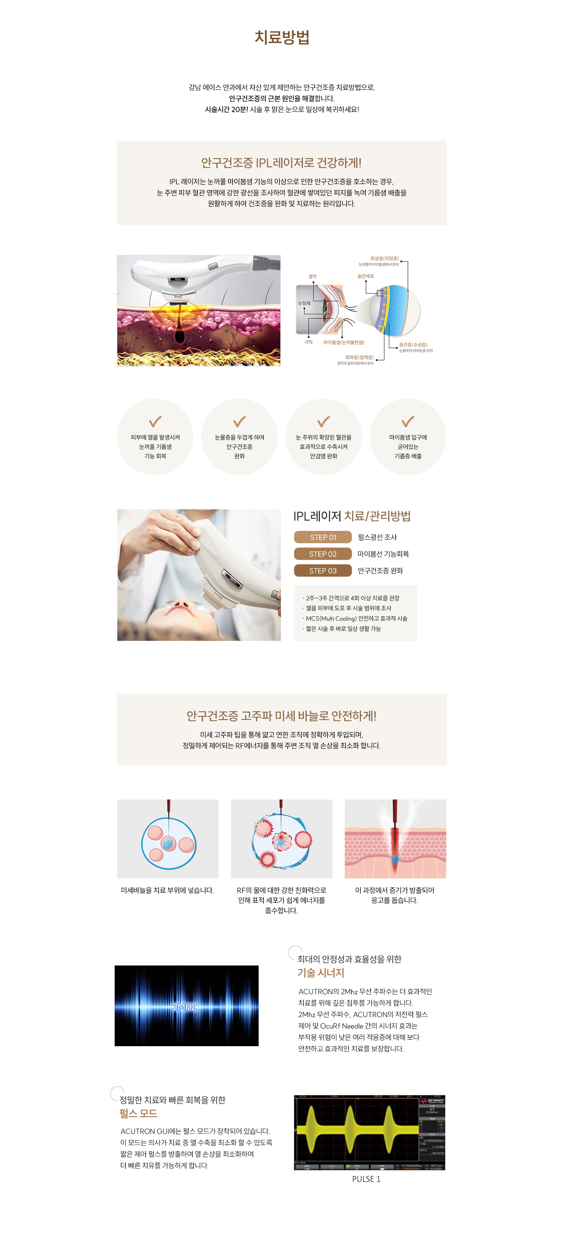 안구건조증